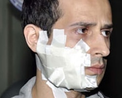 Doktor Hastanede Hastanelik Oldu