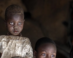 Sudan’da Çocuk Ölümleri Artıyor