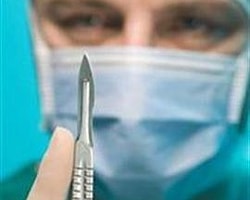 Boşanmak isteyen eşinin dudaklarını yedi