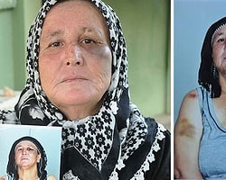 Koca Şiddetinin İzlerini Fotoğrafladı