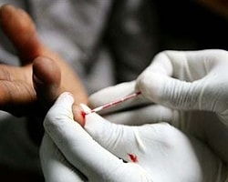 AIDS Testi Cepte