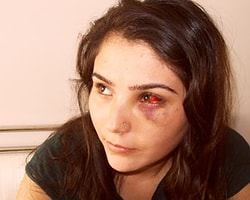 'Gözüme Copla Vurdular'