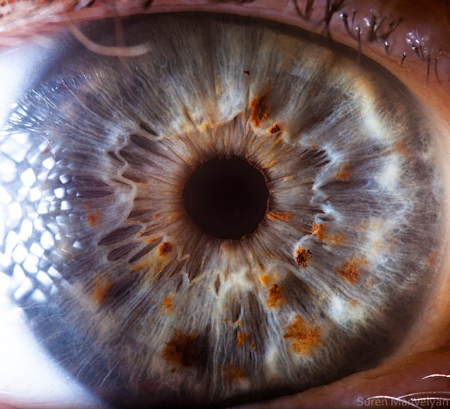 37.