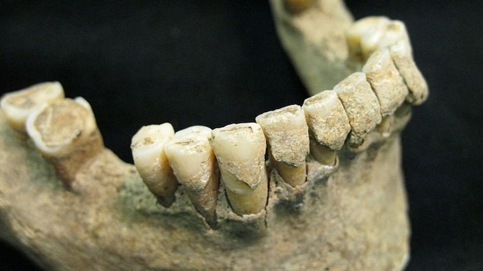 1000 Yıldır Yaşayan Mikrop