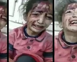 Suriye’de bombalı saldırıda yaralanan çocuğun isyanı...