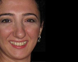 Sinop'ta İşsiz Öğretmen Canına Kıydı