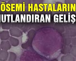 Lösemi Hastalarını Umutlandıran Gelişme