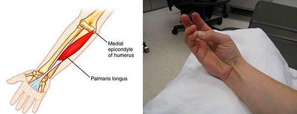 1. İnsanların %15'inde bulunmayan "Palmaris longus" adında bir tendon vardır