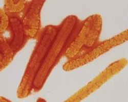 Gine'de Ölümcül Ebola Virüsü 59 Can Aldı