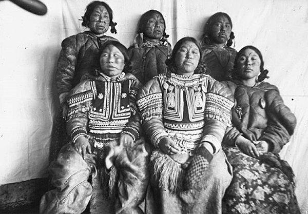 1. Eskimo bebekleri nezle olduğunda anneleri burunlarındaki sümüğü emerek temizler