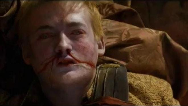 Joffrey Türkiyede Yaşasaydı Olabilecek 5 Olay