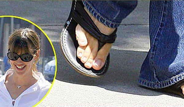 Jennifer Garner’in Bug’ı: Üst üste binmiş sol ayak serçe parmağı