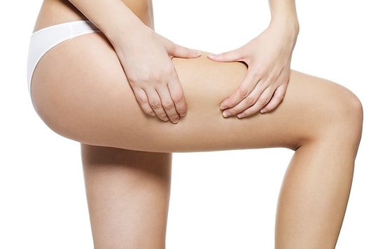 Selülit oluşumuna neden olan faktörler ve selüliti önlemenin doğal yolları