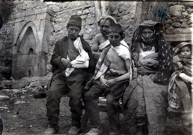 34. I. Dünya Savaşı'ndaki Kafkasya Cephesi çatışmaları esnasında yaralı müslüman mülteciler, Hasankale, 1915