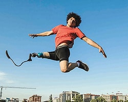 Tek Ayağıyla Hayallerinin Peşinden Koşuyor