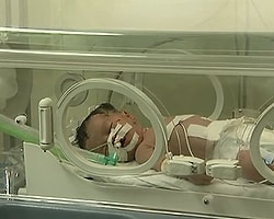 Gazze'nin Mucize Bebeği Yaşam Mücadelesini Kaybetti