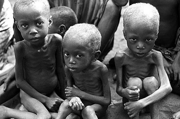 8. Açlıktan ölen çocuklar