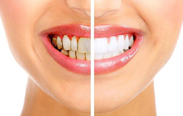 4. Ağız ve diş sağlığımıza özen göstermemek