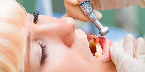 10. Dişin kazınması sırasında oluşan titreşim
