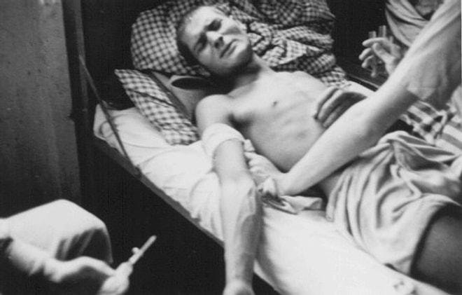 Nazi Tıbbi Deneylerine Ait 20 Tüyler Ürpertici Bilgi