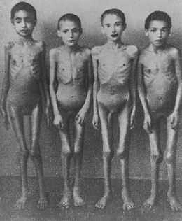 Auschwitz-Birkenau'da Dr. Josef Mengele'nin tıbbî deneylerde kullandığı kurbanlar.