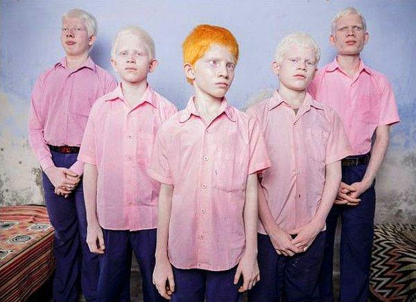 8. Hindistan, Batı Bengal'de özel eğitim aldıkları okuldaki kör Albino çocuklar