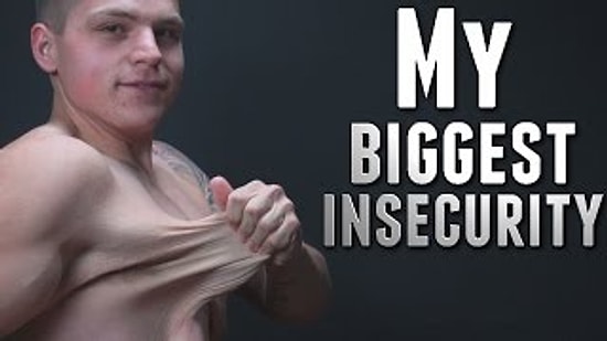 Kilo Verdikten Sonra Deformasyona Uğrayan Vücuduyla Gurur Duyan Adam