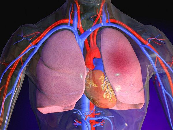6. Kalp kasının yan damarlardan da beslenmesini destekler. Böylece kalbin ana damarlarında oluşacak tıkanıklıkların vereceği zararı azaltır.