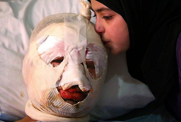 27. Kuzey Lübnan'da bir arabaya konulan bomba sonrasında ağır yaralanan Ahmad al-Messmar'ın kızı, babasını öperken göz yaşlarını tutamıyor.