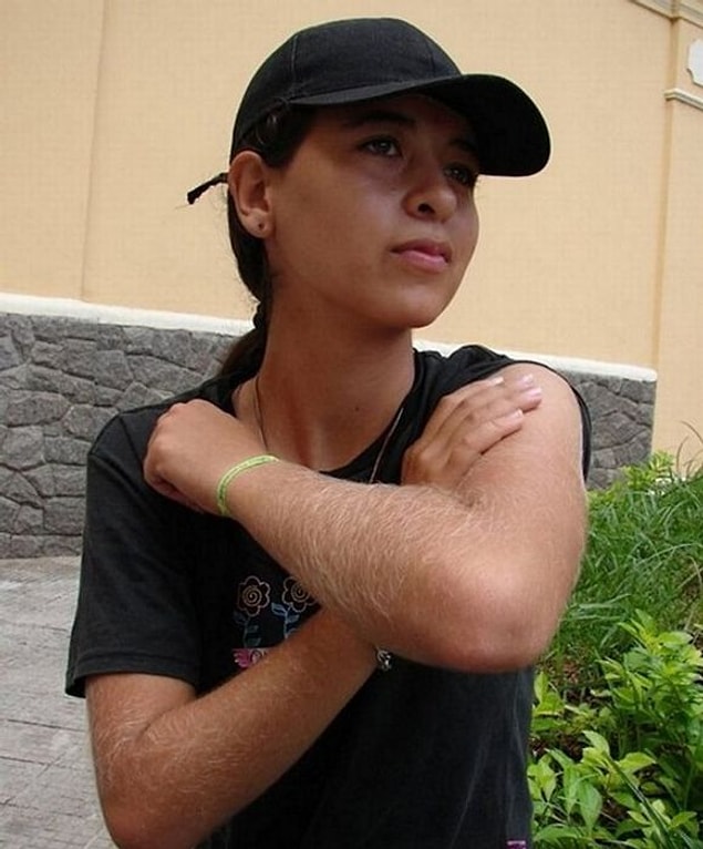 7. "Türkler kıllıdır."