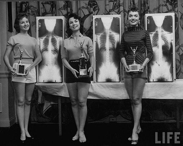 3. Kiropraktör toplantısında, Miss Mükemmel Duruş ödülünü kazanan yarışmacılar, 1956.