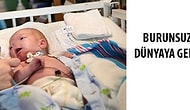 Mucize Bebek 'Eli' Burunsuz Doğdu