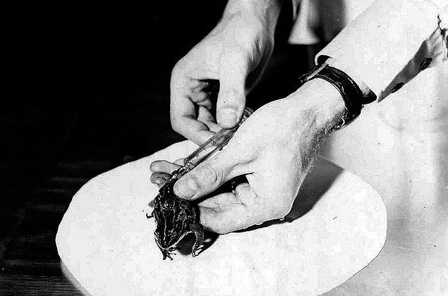 6. 1960'lara kadar bir kadının hamile olup olmadığını anlamak için kadının idrarı African pençeli kurbağasına enjekte edilirdi eğer hamileyse kurbağa 12 saat içinde yumurtlardı.