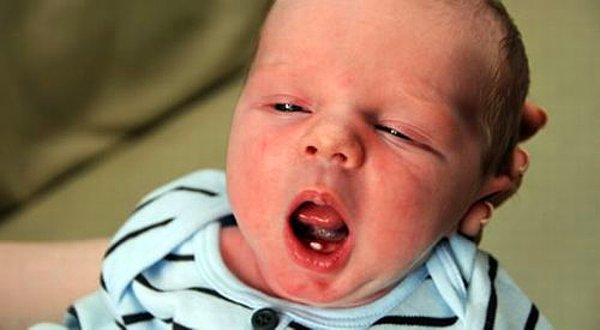 12. Her 2000 bebekten biri bir dişe sahip bir şekilde dünyaya gelir.