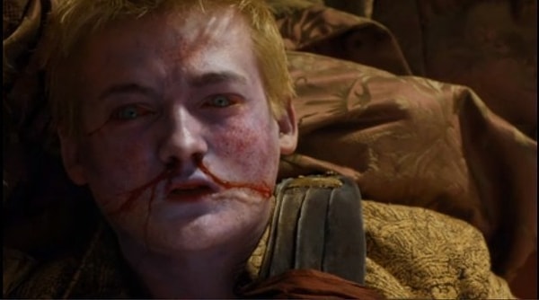 1. Hatırlarsanız Kral Joffrey, Lord Baelish ve Leydi Olenna'nın da yardımıyla kendi düğününde zehirlenmiş, bu da erkek kardeşi Tommen'ı Demir Taht'a çıkarmıştı. Görseli