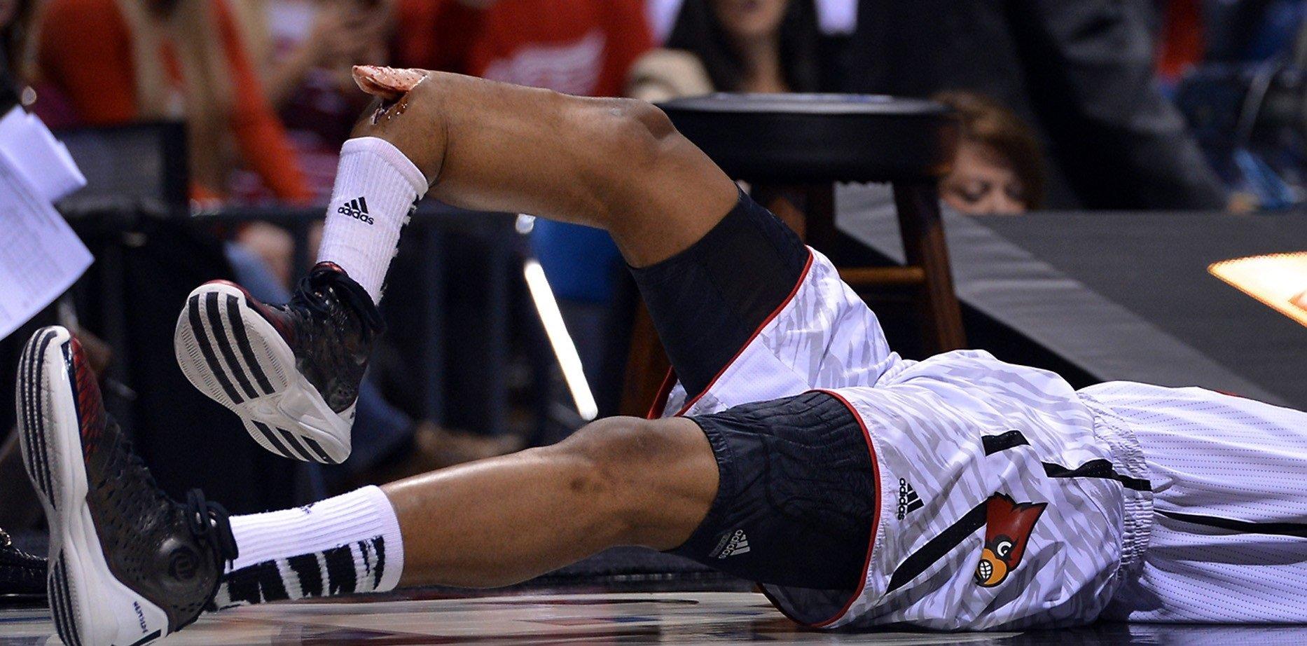 Резкий крутой перелом в чем нибудь. Кевин Уэйр перелом ноги. Пол Джордж баскетболист травма.