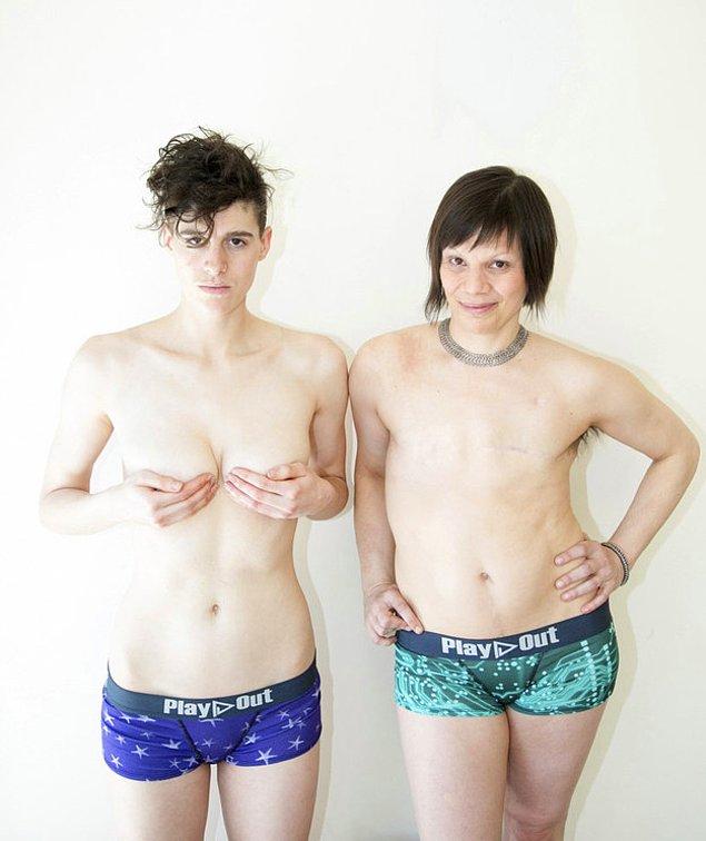 Fotoğraf serisinin ilkinde çift cinsiyetli Rain Dove ile meme kanserini atlatmış Melanie Testa birlikte modellik etmişler.