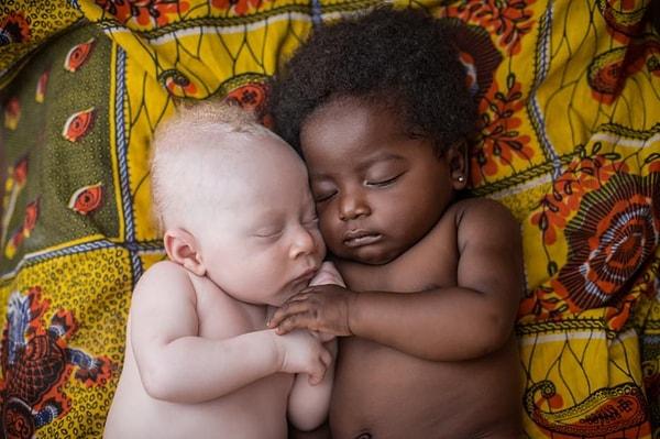18. Henüz 3 haftalık olan albino bebek, kuzeniyle uyurken: