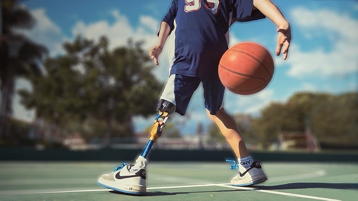 Tek Bacağı Olmayan 9 Yaşındaki Ezra'nın Büyüleyici Hikayesi