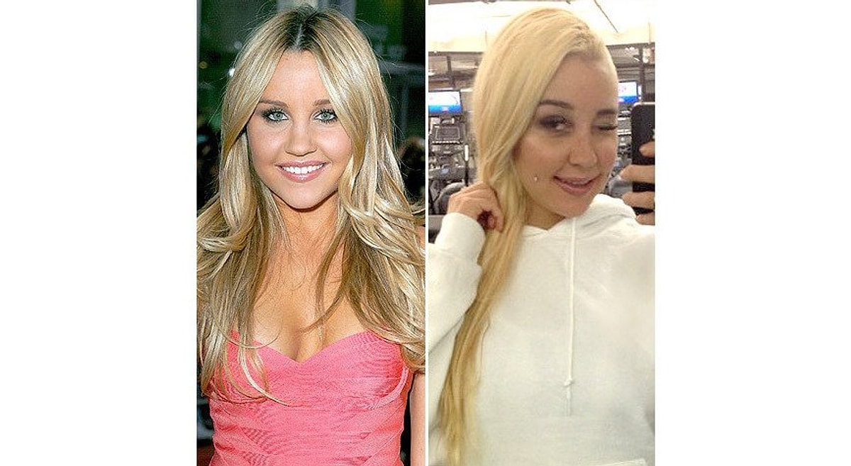 Elayna Carausu Plastic Surgery