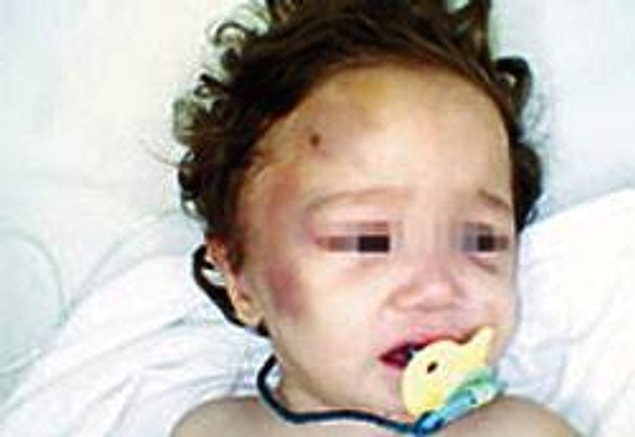 Bu ülkede daha 17 aylık N.N.B gibi, 3 tane hayvan tarafından işkence edilip tecavüze uğrayabilir, beyninizde ödem oluşabilir.