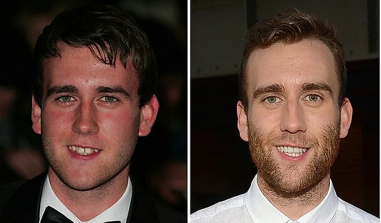 Sihirli Değneğin Yedi Yıl Süresince Yavaş Yavaş Etki Ettiği 15 Şanslı Ünlü