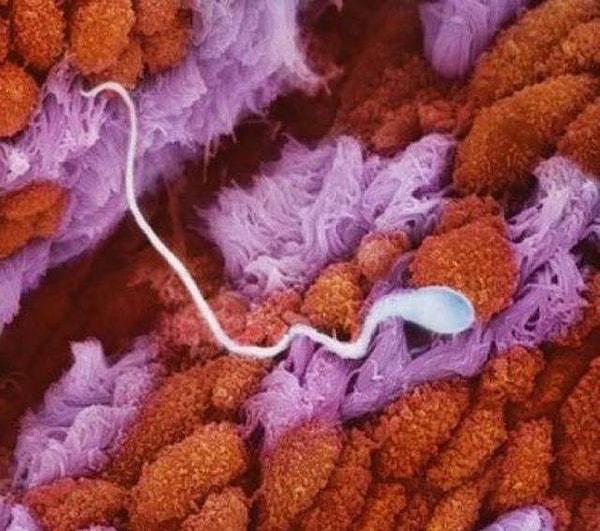 Spermin, fallop tüpüne doğru ilerleyişi