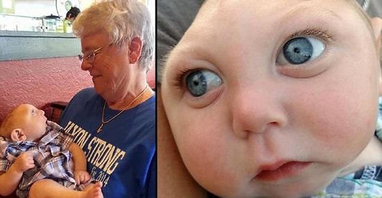 Mucizevi Bebek: Doktorların Birkaç Gün Yaşar Dediği, Kafatası Olmayan Jackson 1 Yaşında