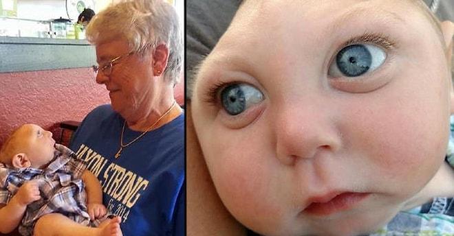 Mucizevi Bebek: Doktorların Birkaç Gün Yaşar Dediği, Kafatası Olmayan Jackson 1 Yaşında