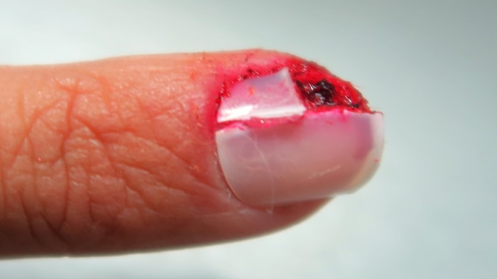 Acımasızca Şakaya Maruz Kalan Kadının İntikam Zamanı: Elde Patlayan Ampul