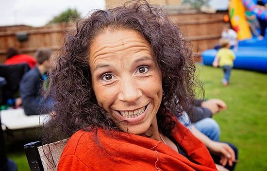 Kemoterapiyi Reddedip, İdrarını İçerek Meme Kanserini Yenmeye Çalışan Kadın