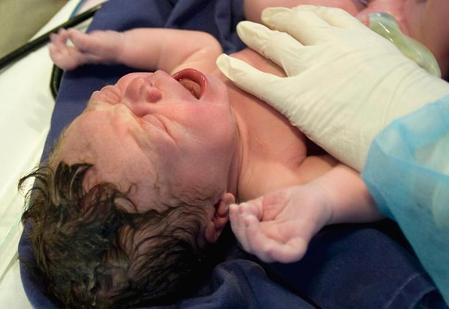 11. CIRCUMCISION (SÜNNET)