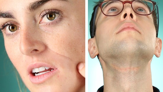 Yaralarınızı Neden Sevmelisiniz?