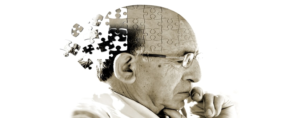 Alzheimer'a Neden Olan Plakları Temizleyen Molekül Bulundu